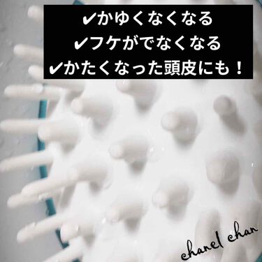 頭皮 かゆみ でこぼこ 頭頂部が固くでこぼこする 血行不良やストレスによる影響