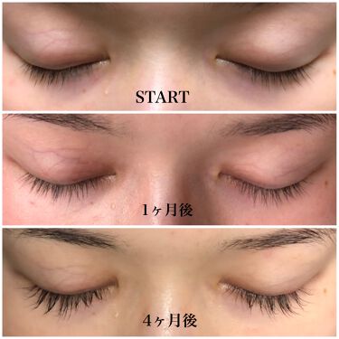 ケアプロスト サン ファーマシューティカルの効果に関する口コミ まつ毛伸びますケアプロスト 07 By ゆきまる 敏感肌 代前半 Lips