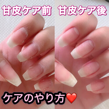 キューティクルリムーバー Bluecrossの口コミ こんにちは 今回は甘皮ケアのやり方を紹介し By みい 混合肌 Lips