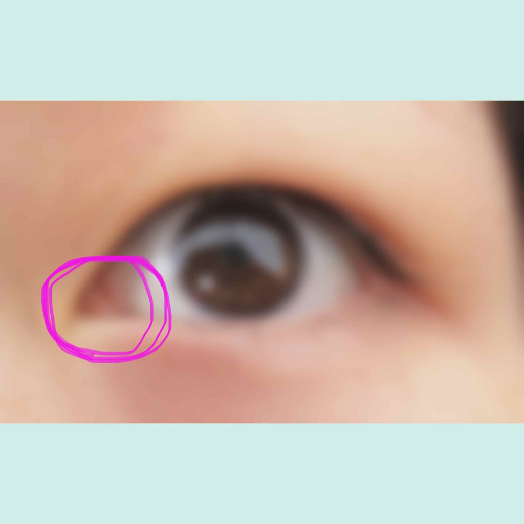 襞 なくす 蒙古