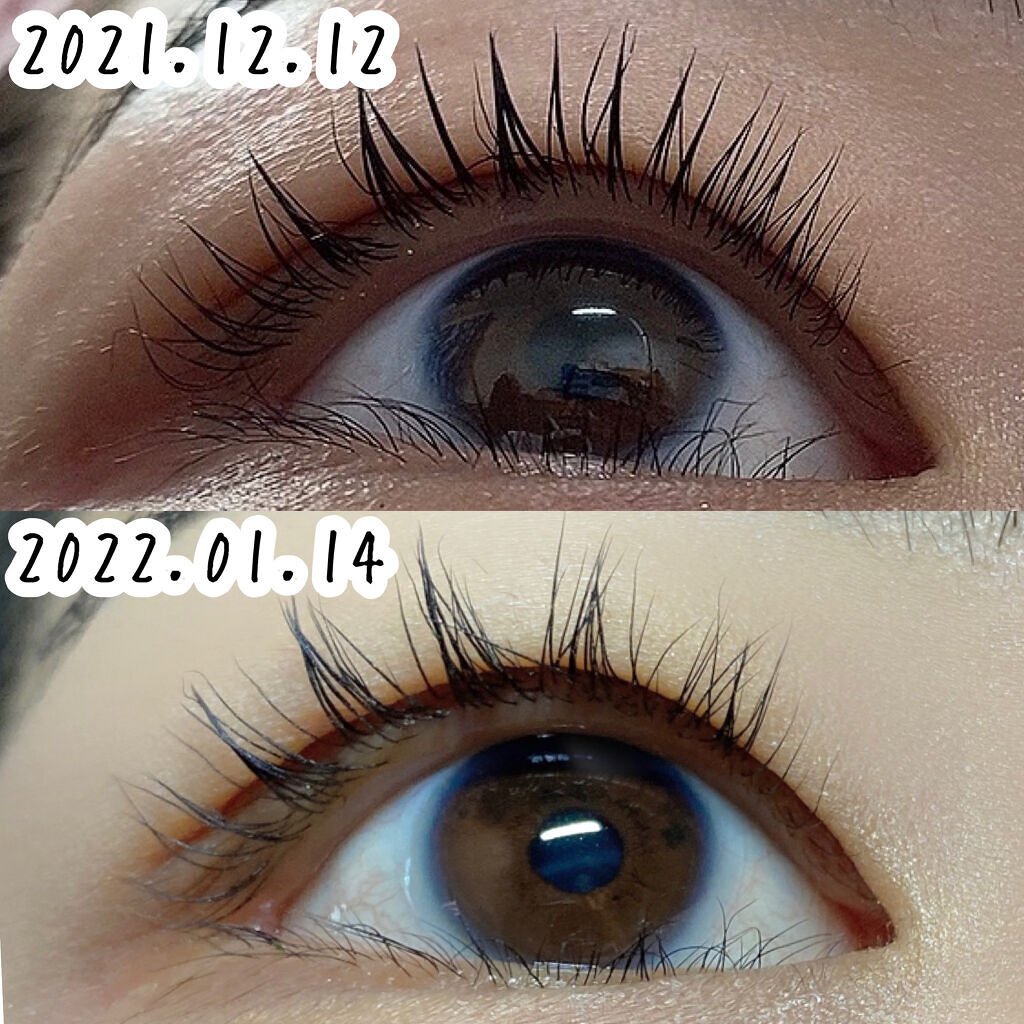 エグータム アルマダスタイルの口コミ 1か月でここまで伸びた 増えたアルマダス By Misora Scosme 毎日投稿 混合肌 代前半 Lips