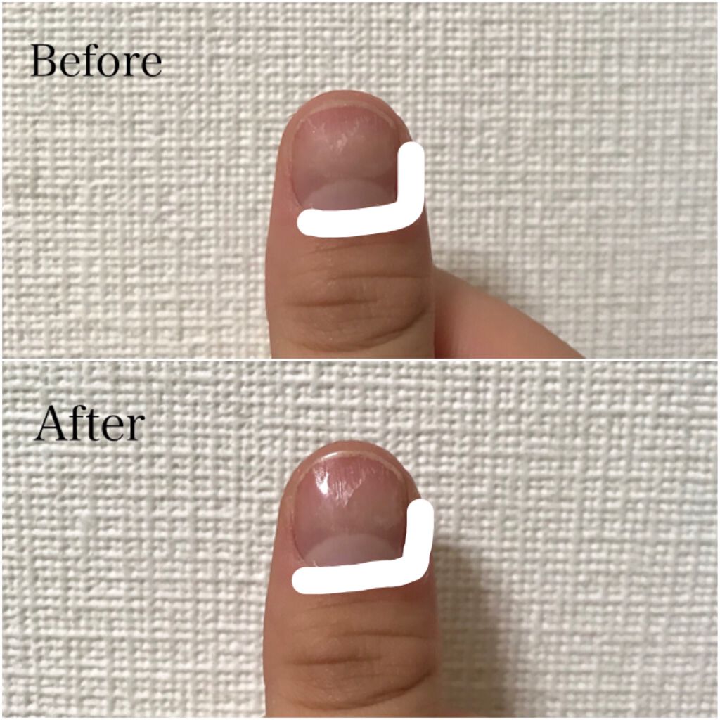 ステンレス爪磨き Daisoの口コミ 超優秀 100均で買えるおすすめネイル用品 ご覧頂きありがとうござ By りー 混合肌 10代後半 Lips