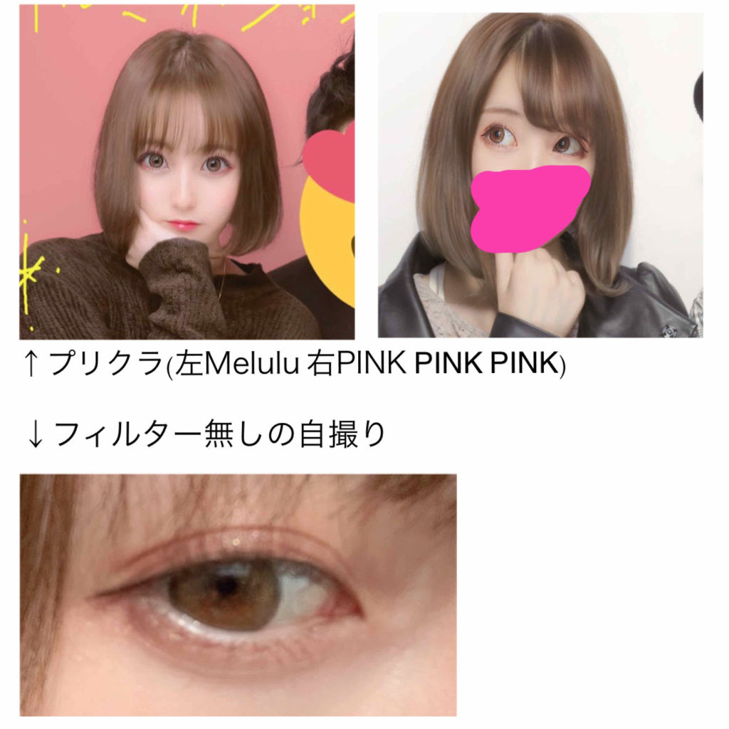 Viviring 1day ビビリング 1day Poplensのカラコンレポ 着画口コミ 三回目の紹介 Viviringbrown By ただの櫻井 敏感肌 代前半 Lips