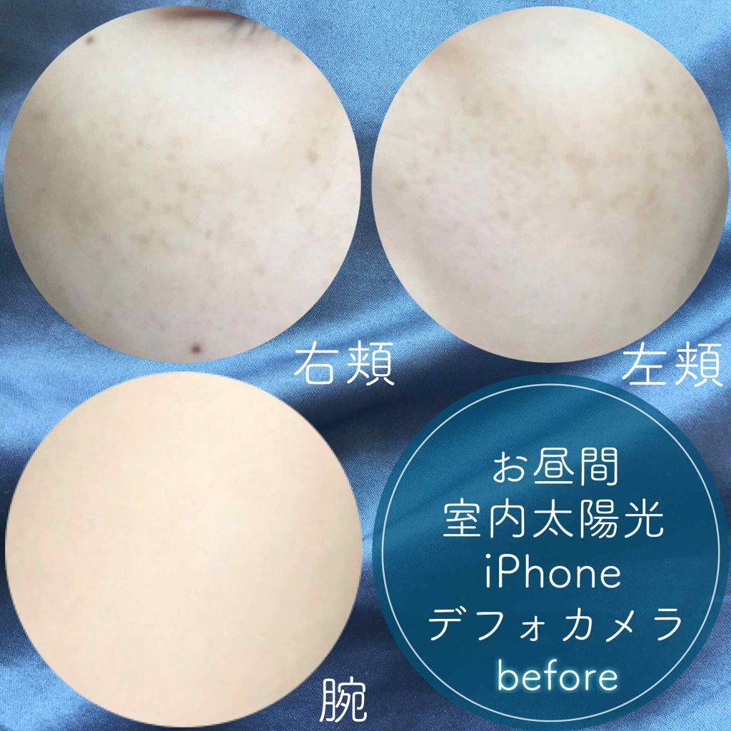 ホワイトcクリア 医薬品 トランシーノの口コミ もい みなさんこんにちは ぽてこ です By ぽてこ 混合肌 20代後半 Lips