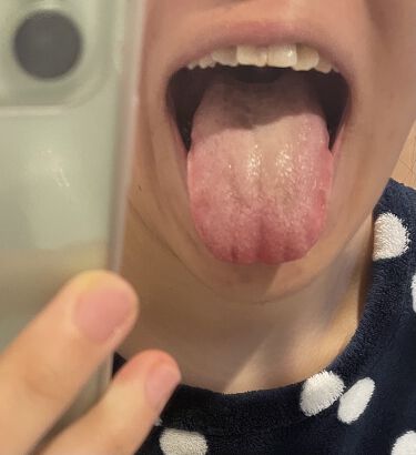 舌磨きをしないほうがいいと言われるのはやり方が間違っているから 口臭の原因 舌苔 を予防しよう Lips