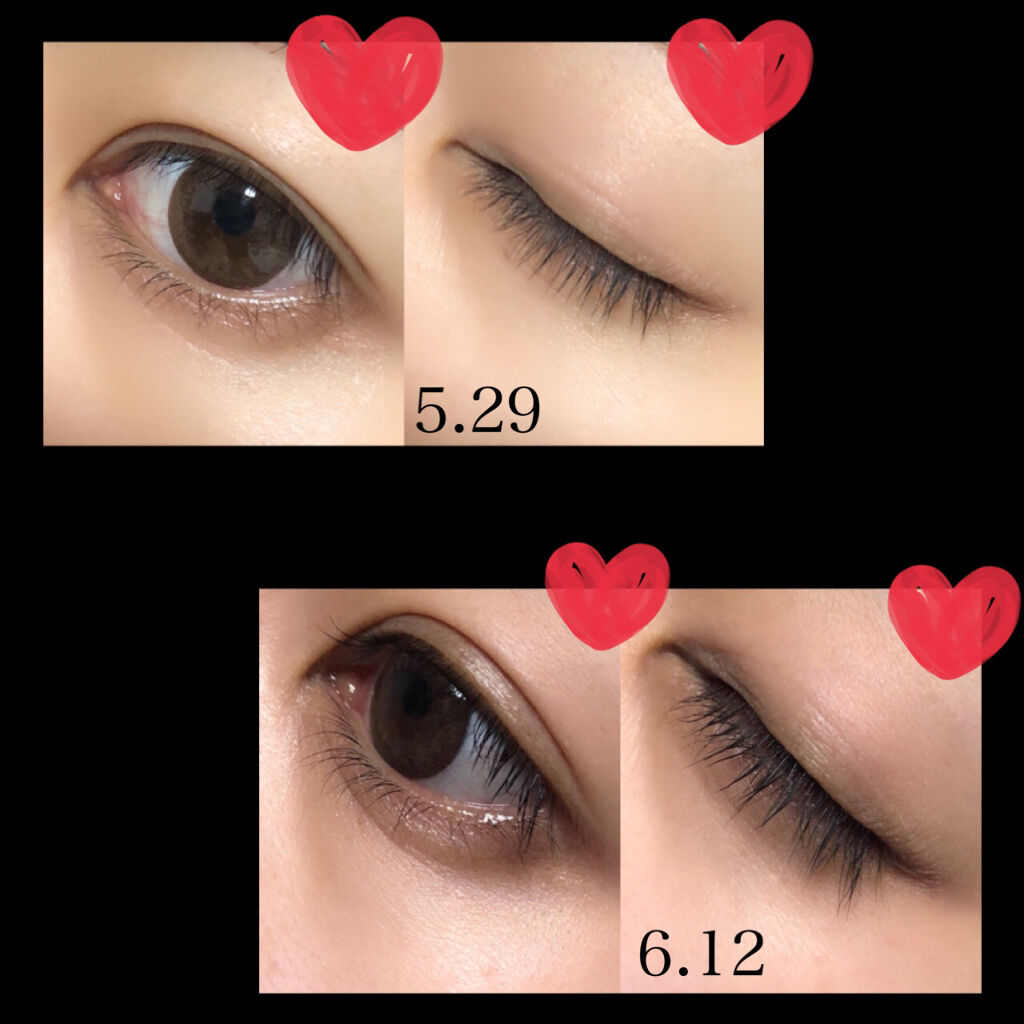 アイラッシュセラム Phoebe Beauty Upの口コミ まつ育記録 21 6 12 使い By Mimi 敏感肌 代後半 Lips