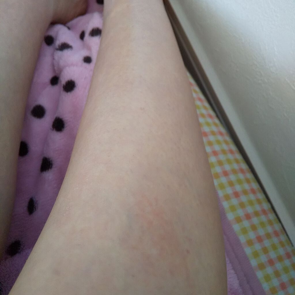 Delemo Delemo 脱毛 除毛 の使い方を徹底解説 初投稿 こんにちは 梨蘭と申します 初めて