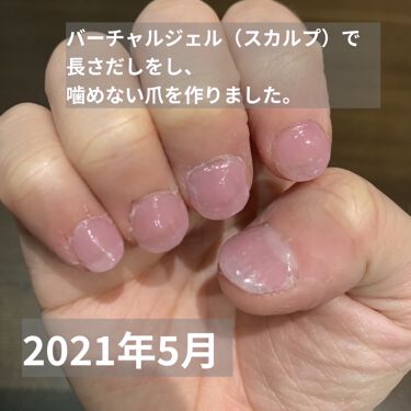 ジェルネイル ジェルミーワンを使った口コミ 深爪を治したい 噛み癖を治したいと思う方の By Miso Lips