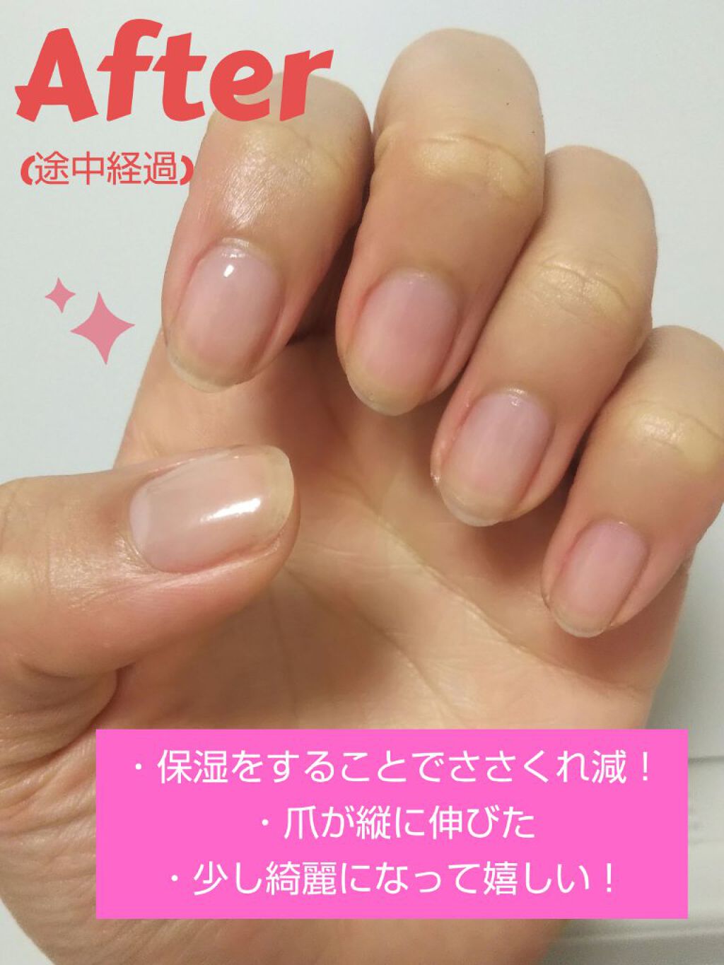 キューティクルネイルオイル ペンタイプ No Nail No Lifeを使った口コミ ゆるっと育爪生活 ずぼら人間でも続けられ By 紡ｰつむぎｰ 脂性肌 10代後半 Lips
