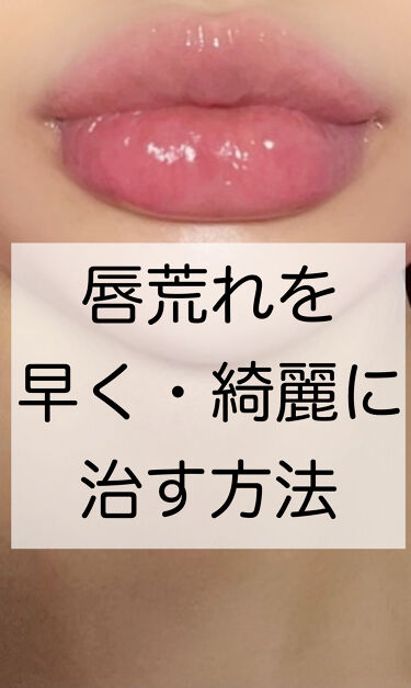 ワセリン 大洋製薬の効果に関する口コミ 唇の皮剥けを早く綺麗に治す方法 唇も日焼 By イエベちゃん 敏感肌 代後半 Lips ワセリン 大洋製薬の効果に関する口コミ 唇の皮剥けを早く綺麗に治す方法 唇も日焼 By イエベちゃん 敏感肌 代後半 Lips