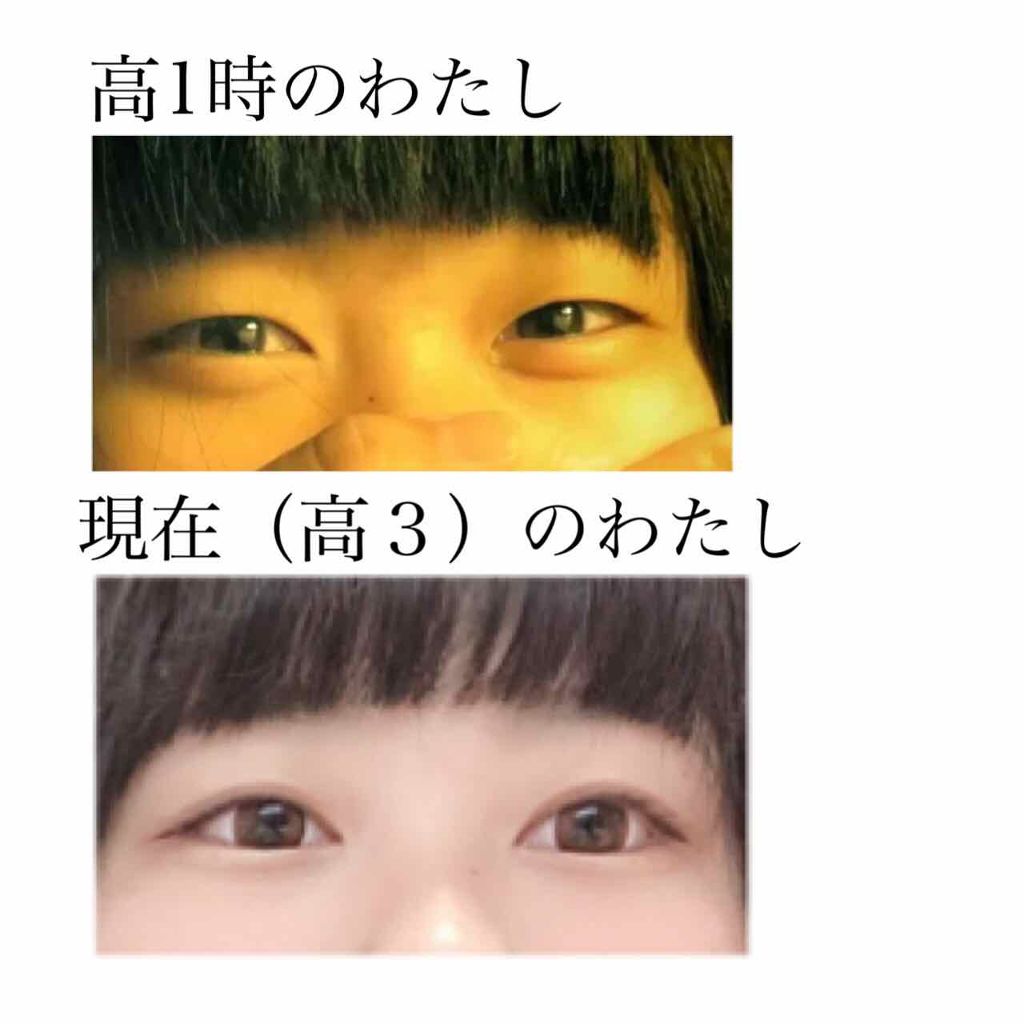 両面アイテープレギュラー Daisoの口コミ 超優秀 100均で買えるおすすめ二重まぶた用アイテム わたしの高校生活を変 By イコ 普通肌 10代後半 Lips