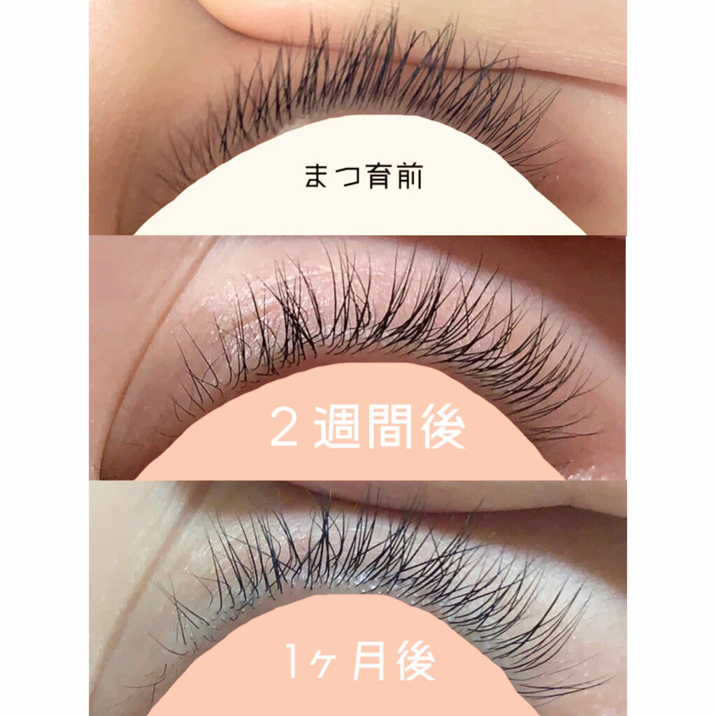 マツパ