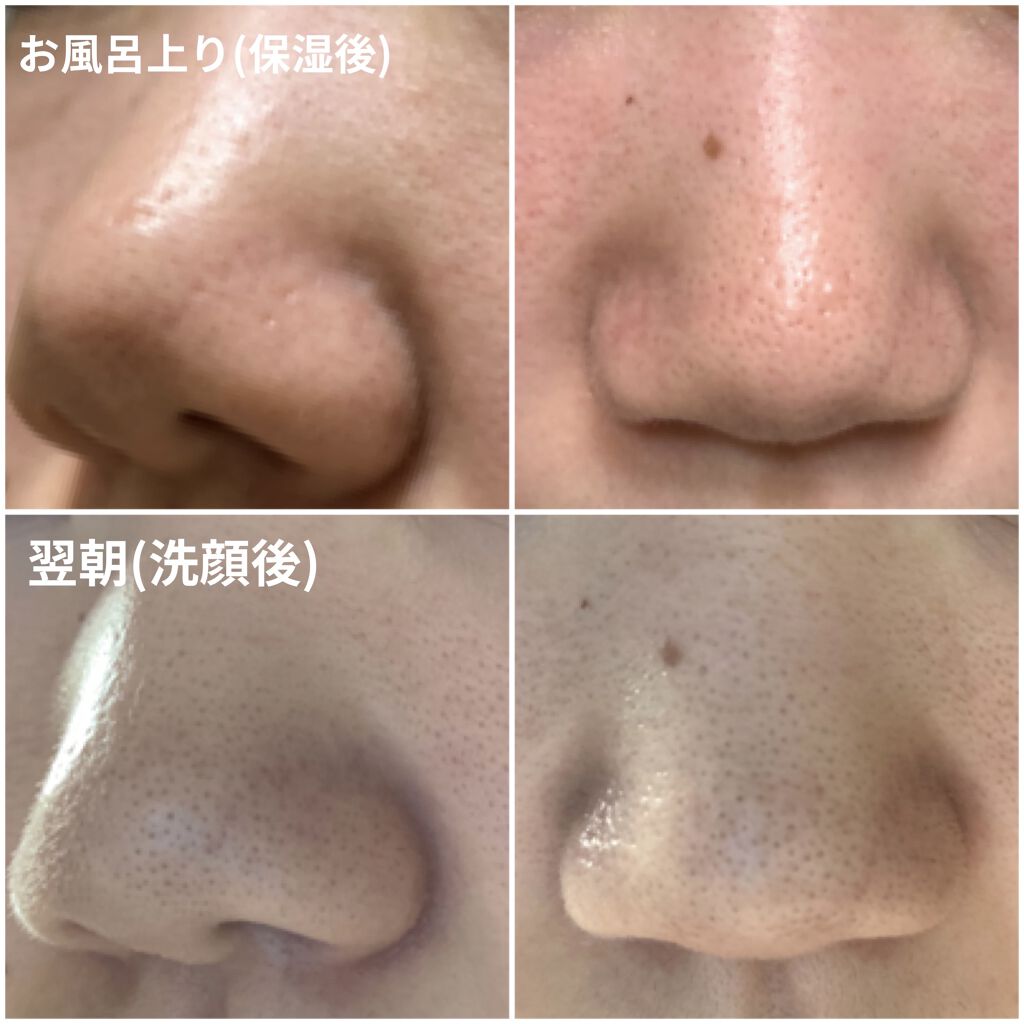 クレンジングバーム モイスト Claygeの口コミ いちご鼻写真あり クレージュクレンジング By たも 脂性肌 代前半 Lips