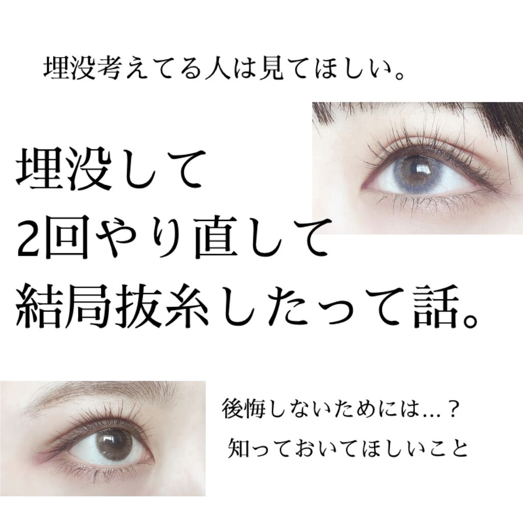 埋没整形 話題沸騰中のコスメ 真似したいメイク方法の口コミが49件 デパコスからプチプラまで Lips