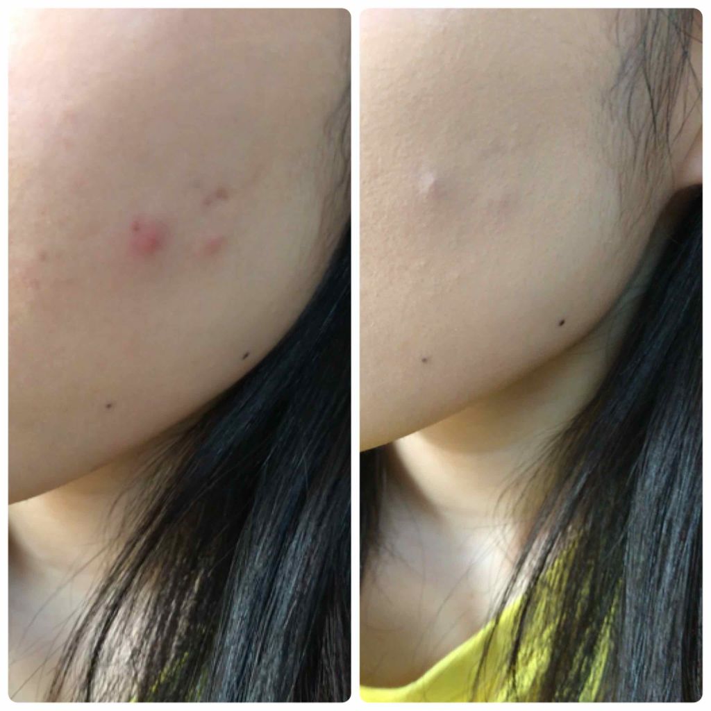 キル カバー コンシール クッション Clioの口コミ Cliokillcoverconcealc By Orange Blush Irr 混合肌 代前半 Lips