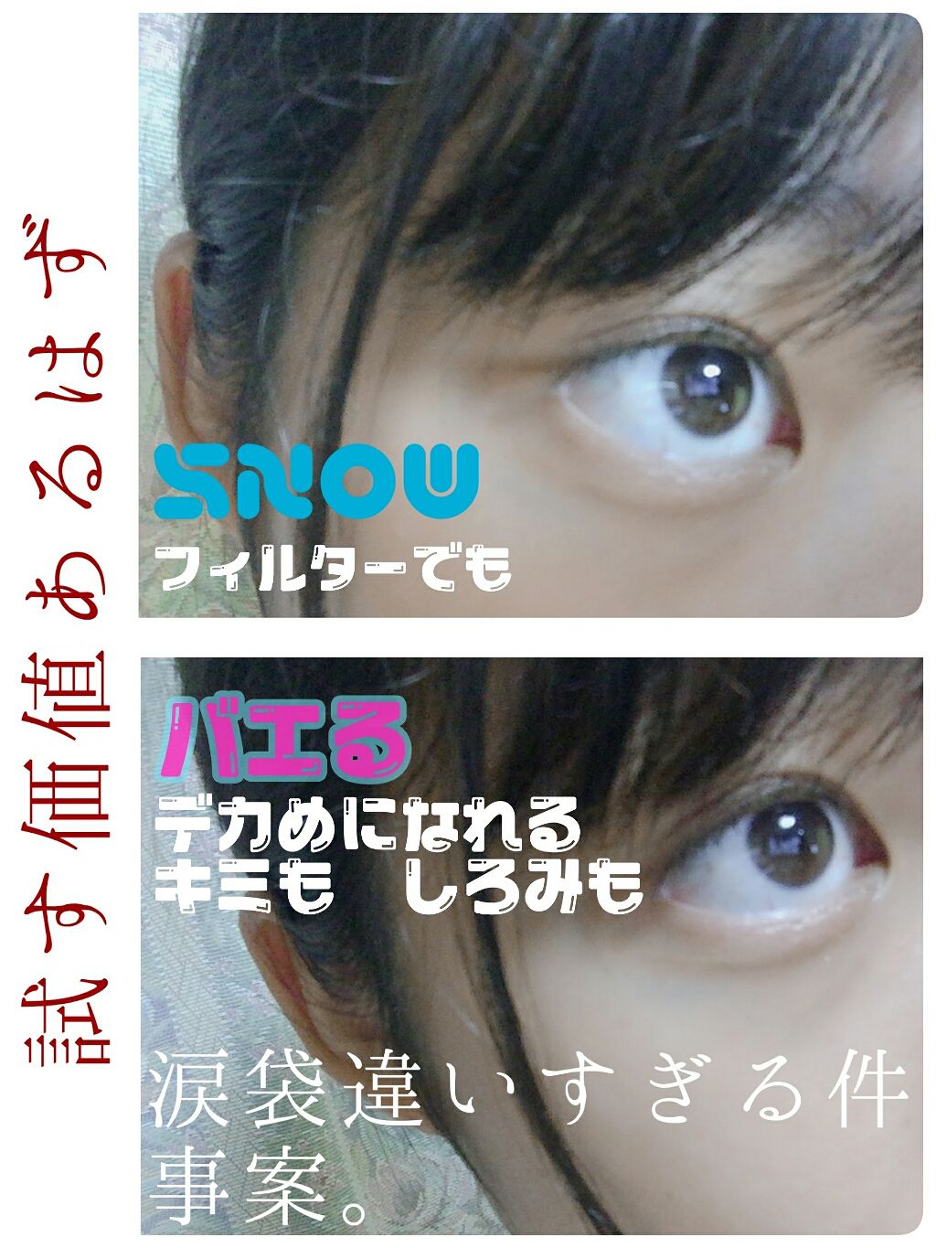 のび る アイテープ 絆創膏タイプ Daisoを使った口コミ こんにちは 二重癖付けの投稿 かなりい By ぶいちゃむ 脂性肌 代後半 Lips