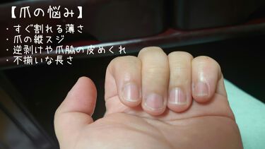 ディープセラム Dr Nailを使った口コミ 今回はレビューではなく 1ヶ月後に結果報 By ヒバリヤ 混合肌 代後半 Lips