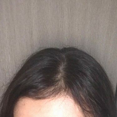 泡カラー 白髪用 ブローネの辛口レビュー セルフ白髪染めビフォーアフターです 泡タイ By ふらんきんせんす ふらん イエベ秋 乾燥肌 40代後半 Lips