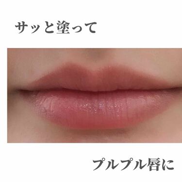 モアリップ N 医薬品 Shiseidoの口コミ 唇の皮向け 荒れ 乾燥がとてもひどくて悩ん By Shiny Lips Tlwe アトピー肌 Lips