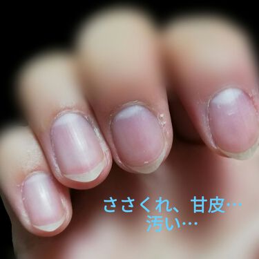 ニベアクリーム ニベアを使った口コミ こんにちは つい最近まで爪が汚かった私が By きなこもち 普通肌 10代後半 Lips