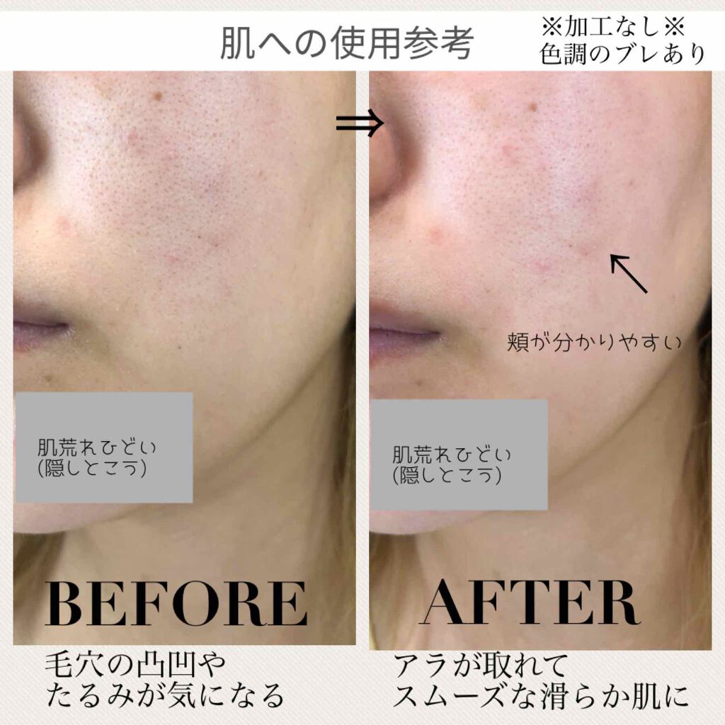 スムースeクリーム Smooth Eの使い方を徹底解説 敏感肌におすすめのフェイスクリーム 肌荒れがひどすぎる日々 By 72coo Natsuco 敏感肌 Lips