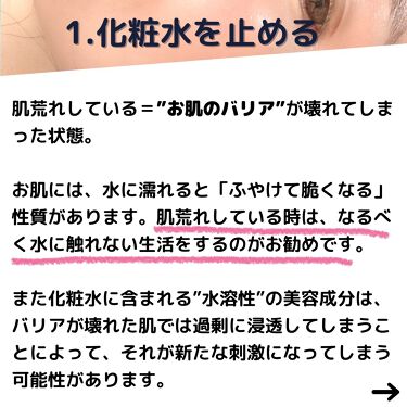 スキンケア方法 潤浸保湿フェイスクリーム キュレルの使い方 効果 肌荒れ治らない時に試す By Mimi スキンケアオタク 美容愛好家 敏感肌 30代後半 Lips