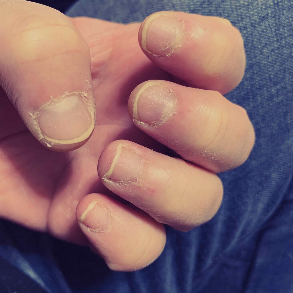 1秒ネイルマジックプレス Dashingdiva Magicpressの口コミ 仕事上 水を使うので手荒れ酷いですが か By たんれい 脱爪噛み 脂性肌 30代前半 Lips