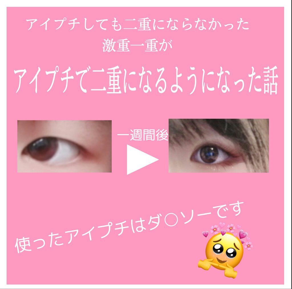 両面二重テープ Daisoの口コミ 超優秀 100均で買えるおすすめ二重まぶた用アイテム こんにちは みそ By みそらーめん フォロバ0 脂性肌 Lips