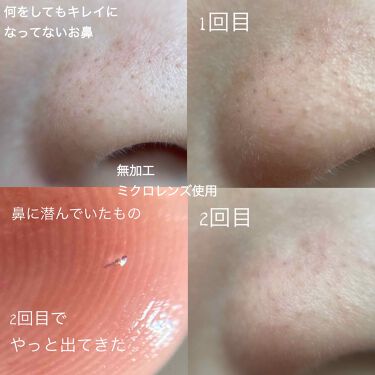 大島椿 ツバキ油 大島椿の口コミ 鼻のドアップ写真があります By Ruamero Cosme Youtube アトピー肌 代前半 Lips