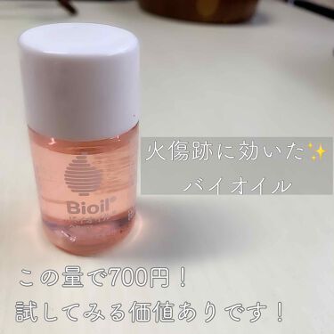 バイオイル バイオイルの口コミ 半年前誤って太ももに熱湯をかけて火傷してし By まるがお 脂性肌 代前半 Lips