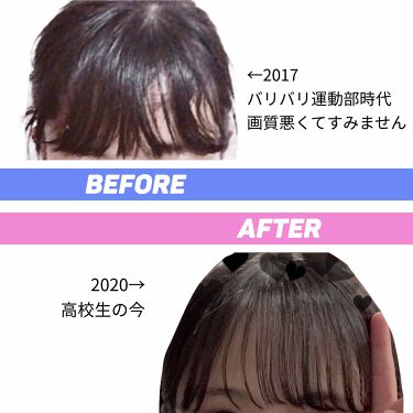 ヘアケア方法 ケープ スーパーハード 無香料 ケープの使い方 効果 前髪の乱れは心の乱れ By ジユちゃん 10代後半 Lips