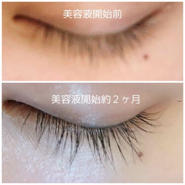 アイラッシュトニック Dhcを使った口コミ マツ育日記 マツ育記録 マツ育開始前に By りーさん 29 混合肌 代後半 Lips