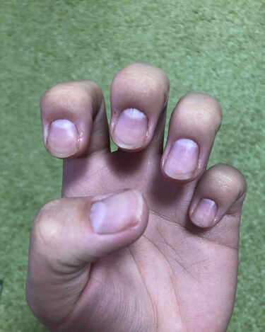 ネイルベッドオイル アンドネイルのリアルな口コミ レビュー Lips