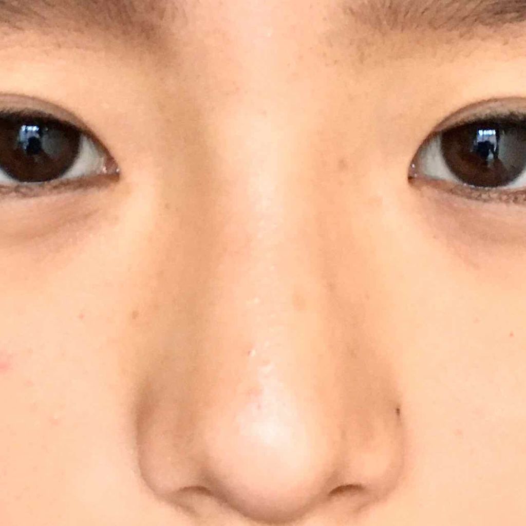 シェーディングスティック Cezanneを使った口コミ 皆さんこんにちは めいポコん 改めめい男 By めいポコん アトピー肌 10代後半 Lips