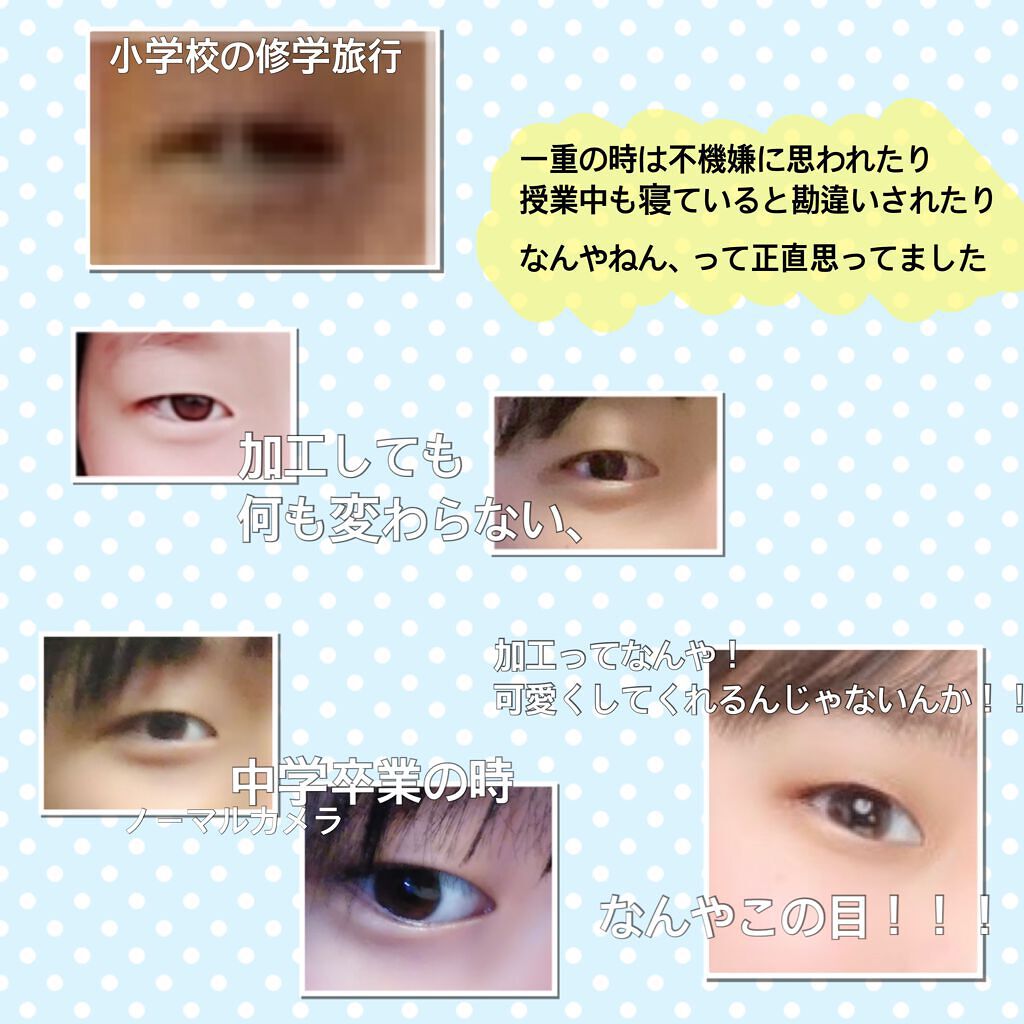 アイビューティーフィクサーwp アストレア ヴィルゴの口コミ アイプチで一重から奥二重に 高校 By いしまる 混合肌 Lips