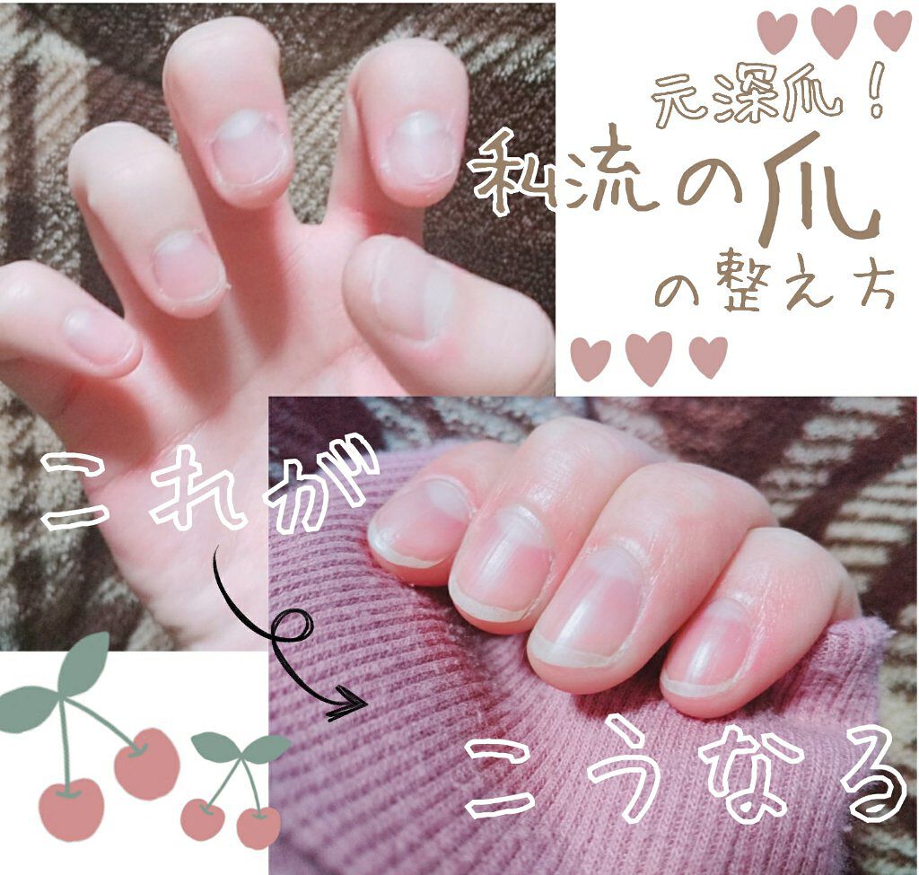 オリジナル ピュアスキンジェリー ヴァセリンを使った口コミ 私の爪の整え方 今回は元々 深爪 By なえ 10代後半 Lips