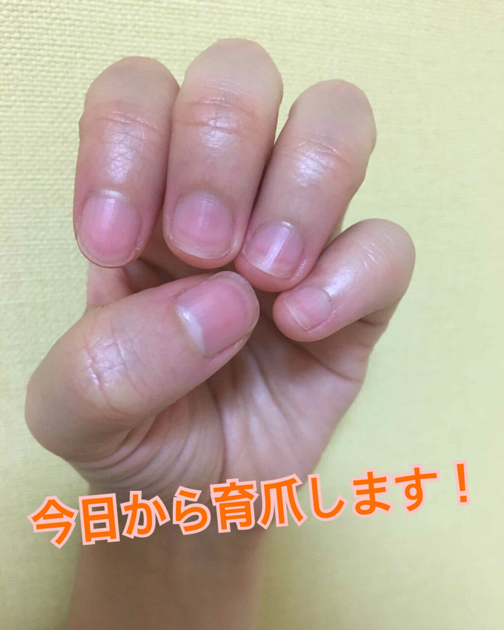 デイケアオイル Dr Nailを使った口コミ 手が小さい上に爪もこんなんじゃ子供みたい By あいこ 敏感肌 代後半 Lips