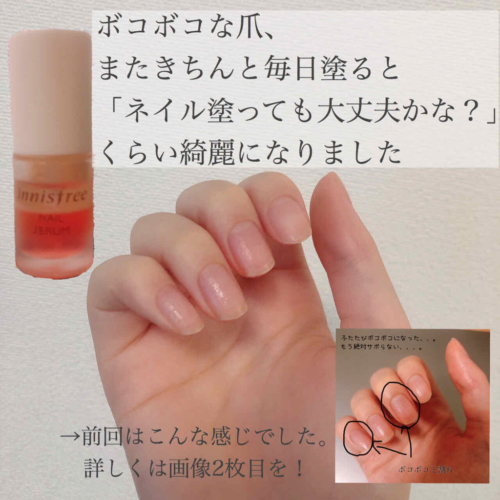 ネイルセラム Innisfreeの口コミ 再び復活したボコボコの爪がまた綺麗になり By Lily 乾燥肌 代前半 Lips