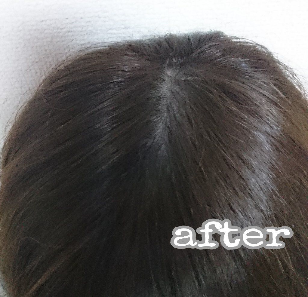 エナジーブリーチカラー メンズパルティの口コミ お気に入りのヘアカラー メンズパルティエナ By りむぅと アトピー肌 30代前半 Lips