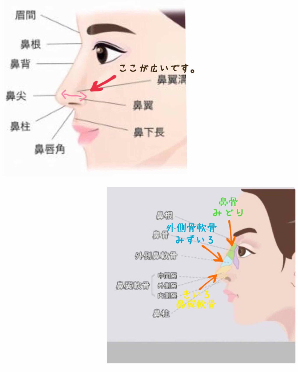 鼻クリップ ロフトファクトリーを使った口コミ Asuka鼻クリップの結果こんにちは あ By Asuka 脂性肌 代前半 Lips