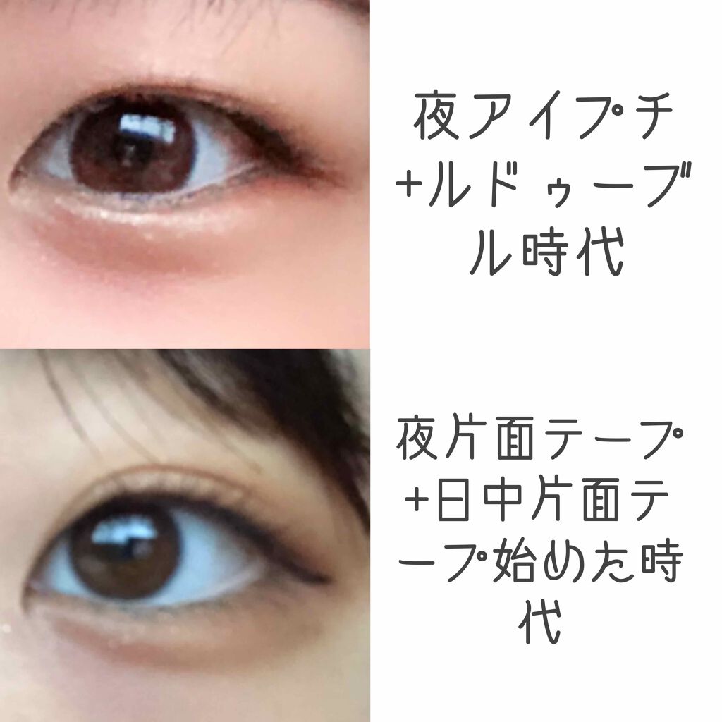 二重になる方法 のび る アイテープ 絆創膏タイプ Daisoの使い方や二重メイク アイプチしてるのはほ By きゃぴ子 乾燥肌 Lips