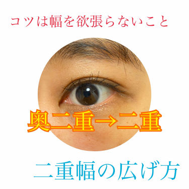 ふたえテープ 目立たず肌になじむ絆創膏タイプ Daisoの口コミ 超優秀 100均で買えるおすすめ二重まぶた用アイテム 寝起きから理想の二重幅 By M 乾燥肌 Lips ふたえテープ 目立たず肌になじむ絆創膏タイプ Daisoの口コミ 超優秀 100均で買えるおすすめ二重まぶた用アイテム 寝起きから理想の二重幅 By M 乾燥肌 Lips