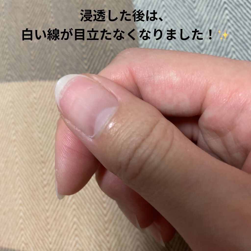 ディープセラム Dr Nailの口コミ Dr Naildeepserumずっと By Ayaka 乾燥肌 Lips