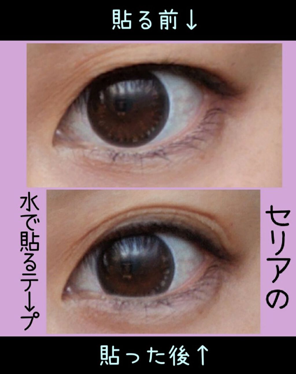 のび る アイテープ 絆創膏タイプ Daisoを使った口コミ 10月29日 金 基本トレーニングメモ By ちゃんえみ 乾燥肌 30代前半 Lips