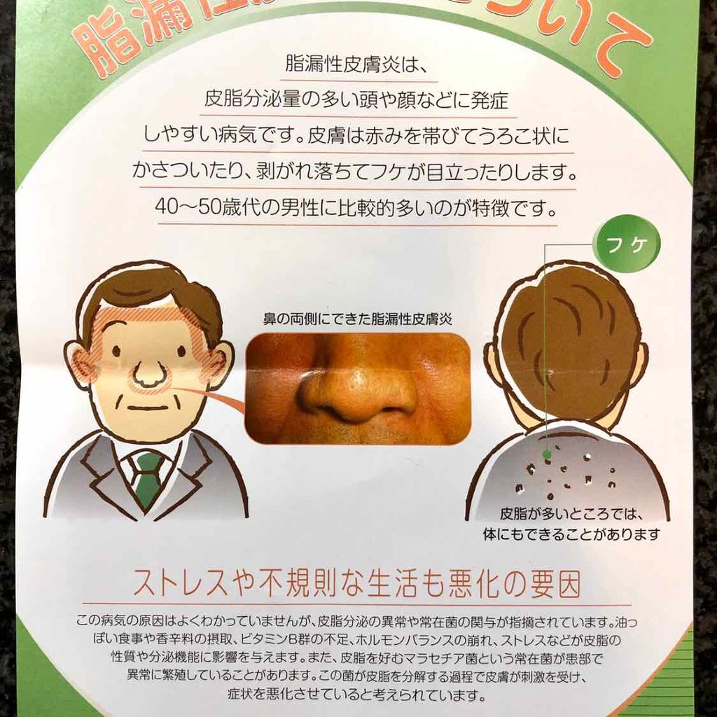 皮脂テカリ防止下地 Cezanneを使った口コミ これは外用薬の抗真菌薬でケトコナゾールクリ By Mocha 混合肌 代前半 Lips