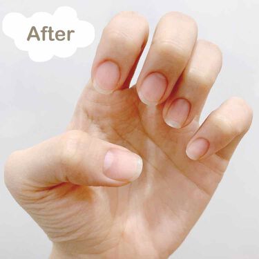 ネイルベッドオイル アンドネイルの口コミ こんにちは 𓅪今日は３ヶ月前から使用してい By Minco 乾燥肌 代後半 Lips