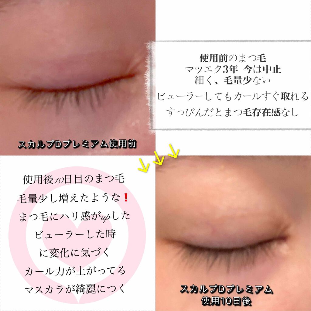 スカルプd ボーテ ピュアフリーアイラッシュセラム プレミアム アンファーの効果に関する口コミ アンファー様からプレゼント スカルプdボ By チョコ 乾燥肌 Lips