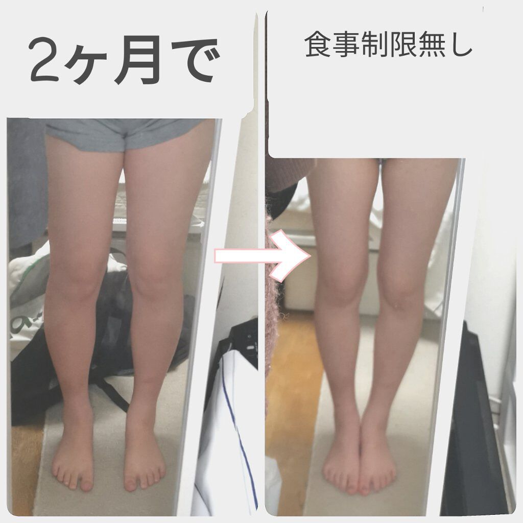 ジョンソン ベビーオイル ジョンソンベビーを使った口コミ 私が2ヶ月で太もも 約7センチ達成した方法 By あめ 脂性肌 10代後半 Lips