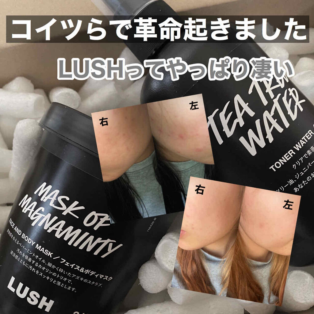 パワーマスク ラッシュを使った口コミ Lushってやっぱり凄い 私のニキビが撲 By ツキ 脂性肌 10代後半 Lips