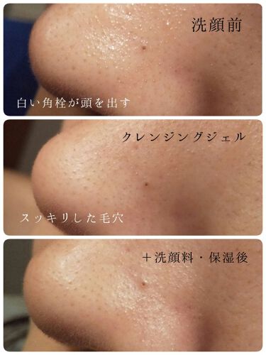 クリアクレンジング Claygeの口コミ クレイ お酢の力で毛穴汚れを落とす ク By いももち 混合肌 代前半 Lips